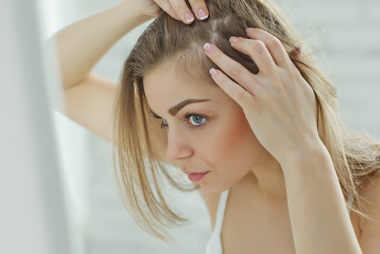 HORMONAL HAIR LOSS